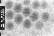 図2:リンホシスチスウイルス