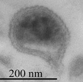 （図1） 世界最小クラスの生命体ARMAN  　　　　Baker, BJ. et al.(2006)Science, 314, 1933-1935