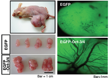 図2. Oct-3/4を強制発現させたグリオーマ細胞。EGFPは増強型緑色蛍光タンパク質であり, その遺伝子を導入することで,グリオーマ細胞の存在を緑色蛍光によって容易に判別できるようにしている。
