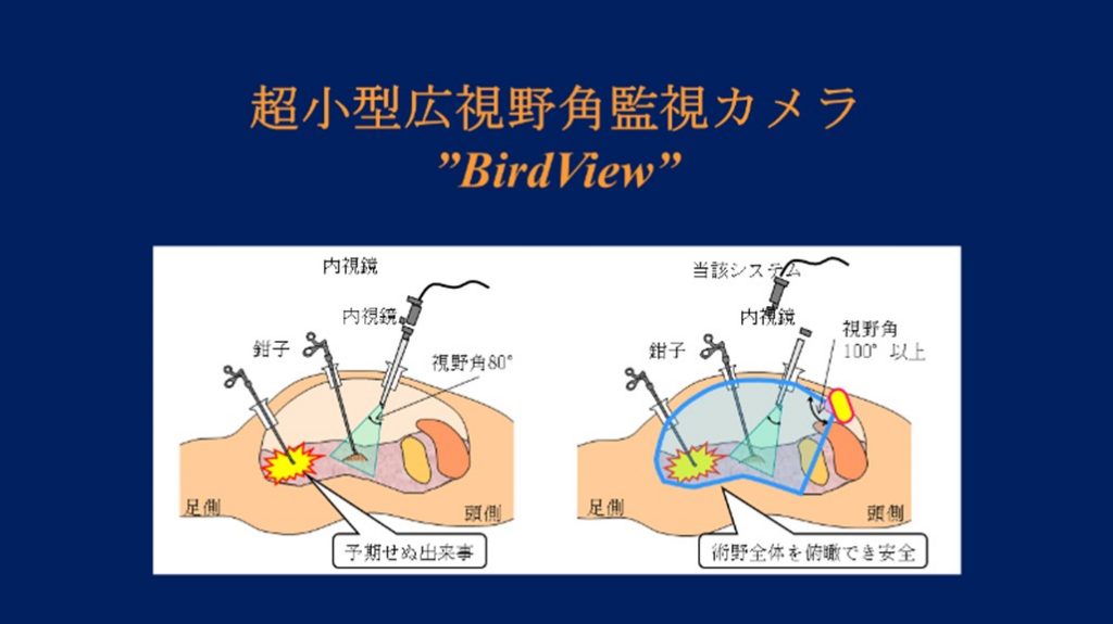 ロボット支援手術の安全性向上を可能とする『超小型広視野角監視カメラBirdView (バードビュー)』を開発