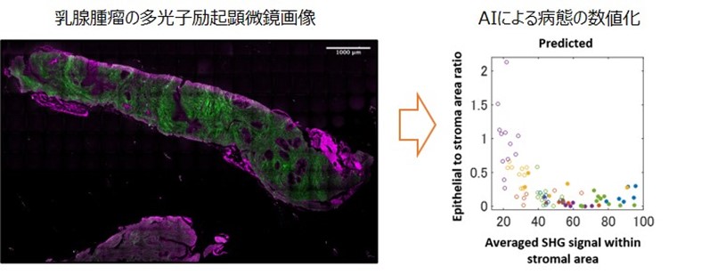 人工知能と最先端顕微鏡を使って乳腺腫瘤を自動診断する技術を開発～病気を数値化するデジタル診断で治療戦略に貢献～