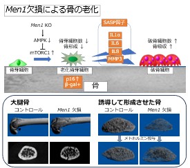 細胞老化が引き起こす骨粗しょう症～骨の老化メカニズムを解明～